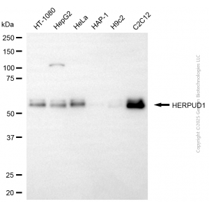 KD-Validated HERPUD1 Mouse mAb (20 μl)