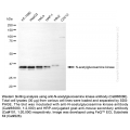 KD-Validated NAGK Mouse mAb (20 μl)