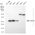 KD-Validated REEP2 Mouse mAb (20 μl)