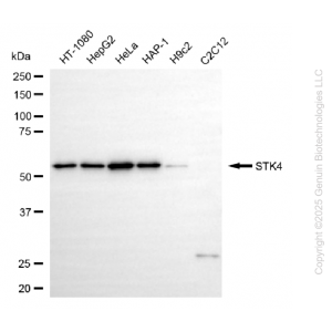 KD-Validated STK4 Rabbit mAb (20 μl)