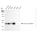 KD-Validated CENPA Rabbit mAb (20 μl)