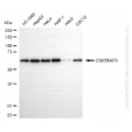 KD-Validated CDK5RAP3 Rabbit mAb (20 μl)