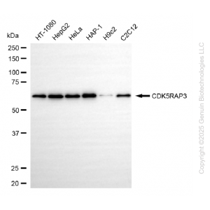 KD-Validated CDK5RAP3 Rabbit mAb (20 μl)