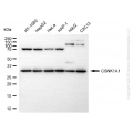 KD-Validated CSNK1A1 Rabbit mAb (20 μl)