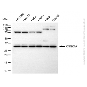 KD-Validated CSNK1A1 Rabbit mAb (20 μl)