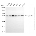 KD-Validated CCNT1 Rabbit mAb (20 μl)