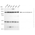 KD-Validated KDM2A Rabbit mAb (20 μl)