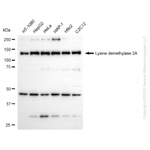 KD-Validated KDM2A Rabbit mAb (20 μl)