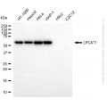 KD-Validated LPCAT1 Rabbit mAb (20 μl)