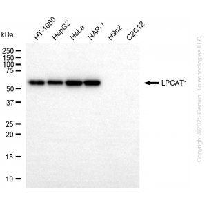 KD-Validated LPCAT1 Rabbit mAb (20 μl)
