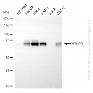 KD-Validated MTHFR Rabbit mAb (20 μl)