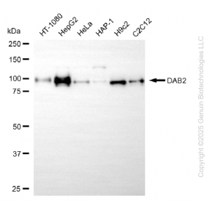 KD-Validated DAB2 Rabbit mAb (20 μl)