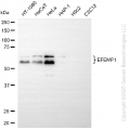 KD-Validated EFEMP1 Rabbit mAb (20 μl)