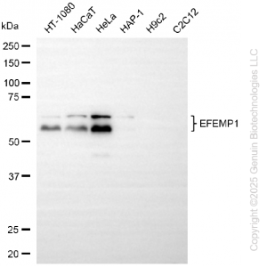 KD-Validated EFEMP1 Rabbit mAb (20 μl)