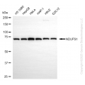 KD-Validated NDUFS1 Rabbit mAb (20 μl)