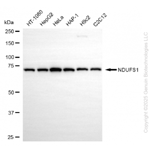 KD-Validated NDUFS1 Rabbit mAb (20 μl)
