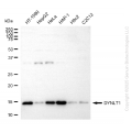 KD-Validated DYNLT1 Rabbit mAb (20 μl)