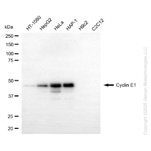 KD-Validated CCNE1 Rabbit mAb (20 μl)