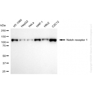 KD-Validated NOTCH1 Rabbit mAb (20 μl)