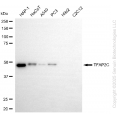 KD-Validated TFAP2C Rabbit mAb (20 μl)