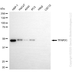KD-Validated TFAP2C Rabbit mAb (20 μl)