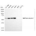KD-Validated ME2 Rabbit mAb (20 μl)