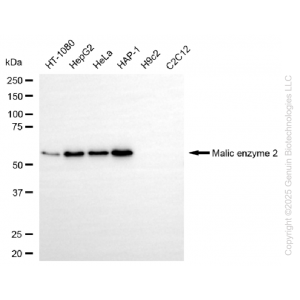 KD-Validated ME2 Rabbit mAb (20 μl)