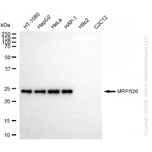 KD-Validated MRPS26 Rabbit mAb (20 μl)