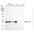 KD-Validated UBE2F Rabbit mAb (20 μl)