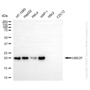 KD-Validated UBE2F Rabbit mAb (20 μl)