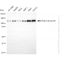 KD-Validated PKN1 Rabbit mAb (20 μl)