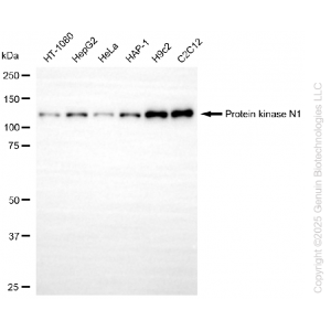 KD-Validated PKN1 Rabbit mAb (20 μl)