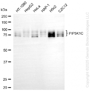 KD-Validated PIP5K1C Rabbit mAb (20 μl)
