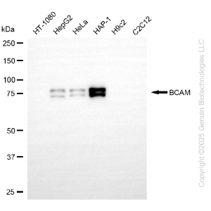 KD-Validated BCAM Rabbit mAb (20 μl)