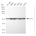 KD-Validated CCT2 beta Rabbit mAb (20 μl)