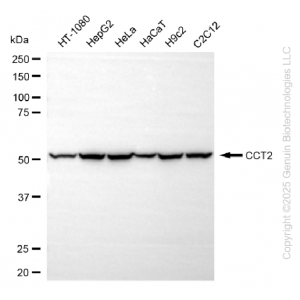 KD-Validated CCT2 beta Rabbit mAb (20 μl)