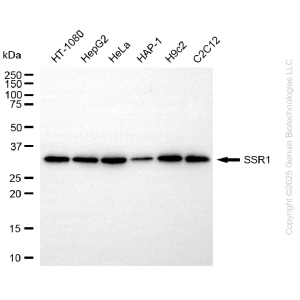 KD-Validated SSR1 Rabbit mAb (20 μl)
