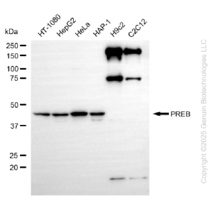 KD-Validated PREB Rabbit mAb (20 μl)