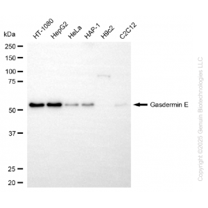 KD-Validated GSDME Rabbit mAb (20 μl)