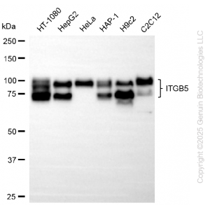KD-Validated ITGB5 Rabbit mAb (20 μl)