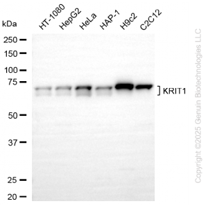KD-Validated KRIT1 Rabbit mAb (20 μl)