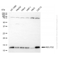 KD-Validated NDUFB2 Rabbit mAb (20 μl)