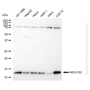 KD-Validated NDUFB2 Rabbit mAb (20 μl)