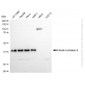 KD-Validated NUDT9 Rabbit mAb (20 μl)