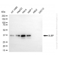 KD-Validated SLBP Rabbit mAb (20 μl)