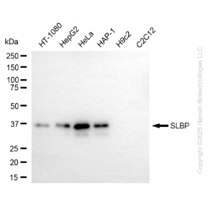 KD-Validated SLBP Rabbit mAb (20 μl)