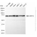 KD-Validated SRP72 Rabbit mAb (20 μl)