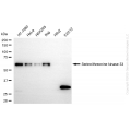KD-Validated STK33 Rabbit mAb (20 μl)