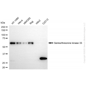 KD-Validated STK33 Rabbit mAb (20 μl)