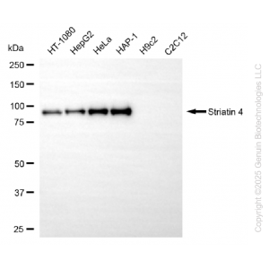 KD-Validated STRN4 Rabbit mAb (20 μl)